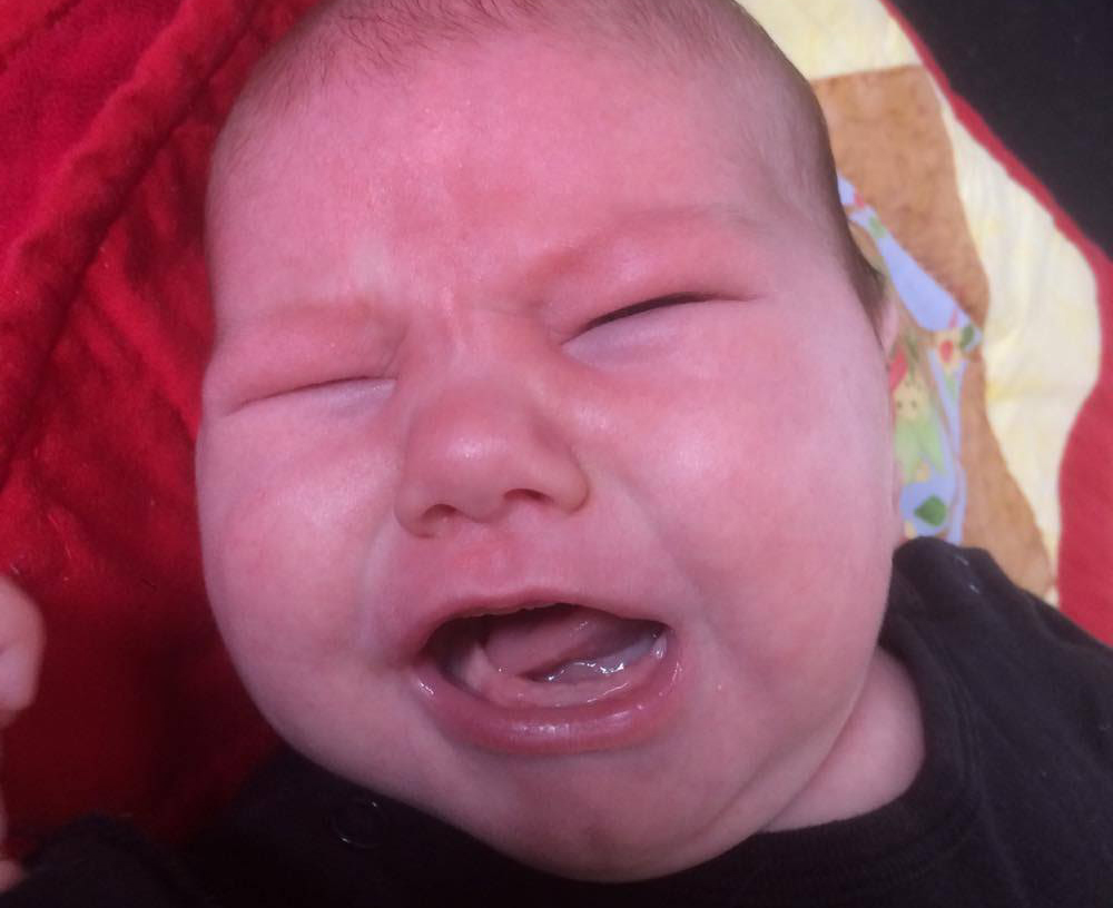 Stramt kort tungebånd baby symptomer tungen ligger lavt ved gråd og er skålformet